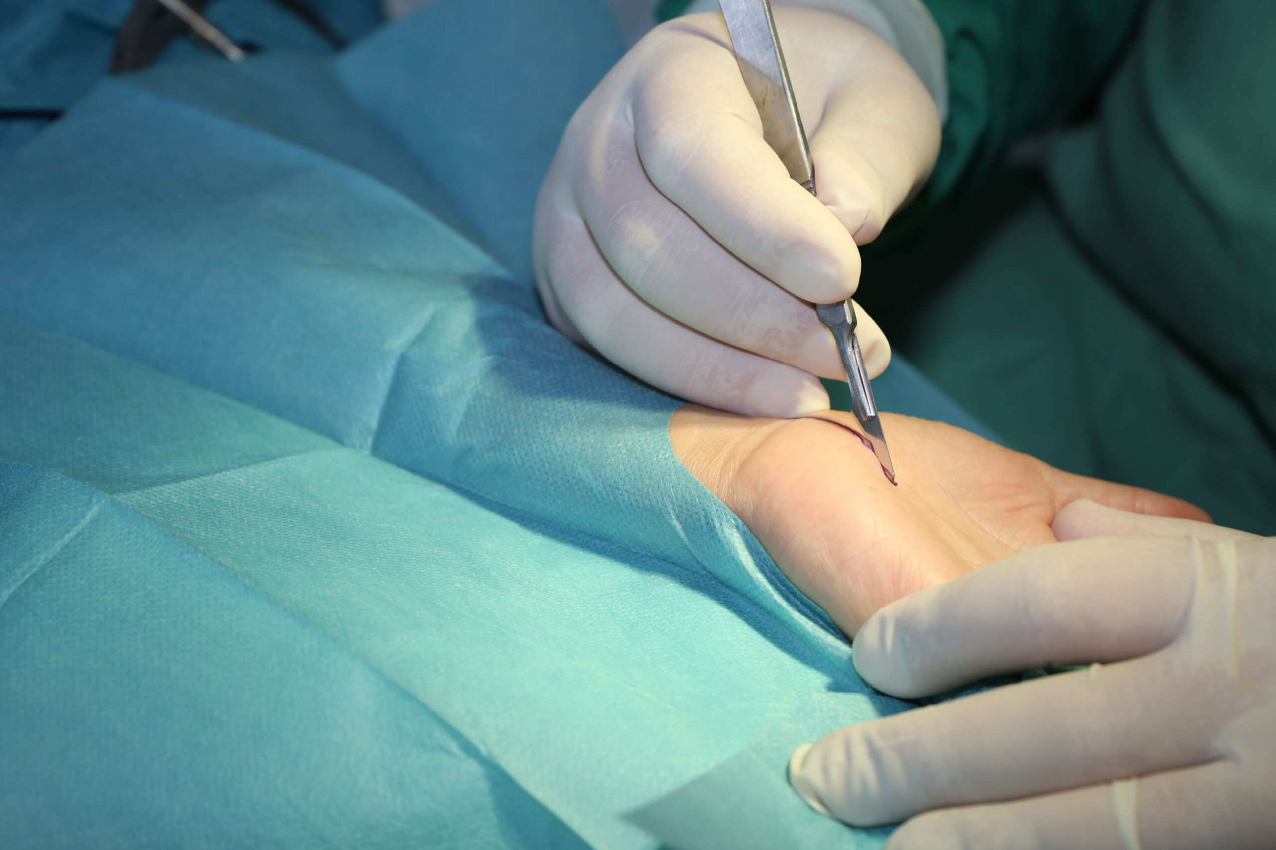 Surgeon making incision for carpal tunnel surgery